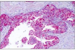Human Prostate, Epithelium: Formalin-Fixed, Paraffin-Embedded (FFPE) (PTTG1IP antibody  (Internal Region))