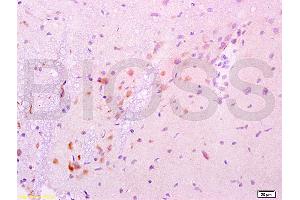 Formalin-fixed and paraffin embedded rat brain labeled with Anti-GDNF Polyclonal Antibody, Unconjugated (ABIN736536) at 1:200 followed by conjugation to the secondary antibody and DAB staining. (GDNF antibody  (AA 121-211))