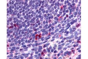 Anti-CCR2 antibody IHC of human spleen, lymphocytes. (CCR2 antibody  (N-Term))