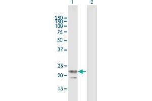 Western Blot analysis of TRGV3 expression in transfected 293T cell line by TRGV3 MaxPab polyclonal antibody. (TRGV3 antibody  (AA 1-200))
