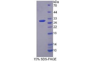 Image no. 1 for Membrane Protein, Palmitoylated 2 (MAGUK P55 Subfamily Member 2) (MPP2) (AA 345-573) protein (His tag) (ABIN4988492)