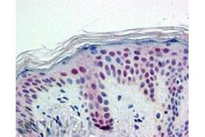 PTBP1 polyclonal antibody (Cat # PAB6476, 5 ug/mL) staining of paraffin embedded Human Skin.