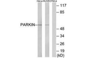Western blot analysis of extracts from HeLa/HuvEc cells, using Parkin (Ab-131) Antibody.