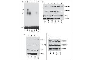 Western Blotting (WB) image for anti-COL1A2/COL1A1 antibody (ABIN5596819)
