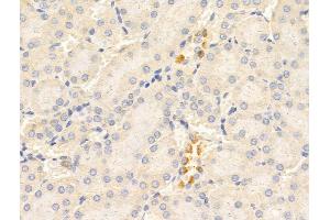 ABIN6265820 and ABIN6268771 at 1/100 staining Rat kidney tissue by IHC-P.