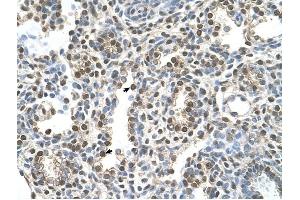 MAGEA8 antibody was used for immunohistochemistry at a concentration of 16. (MAGEA8 antibody  (N-Term))
