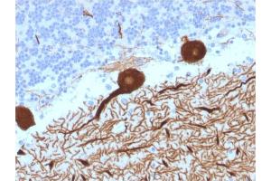 Immunohistochemistry (IHC) image for anti-Carbonic Anhydrase VIII (CA8) antibody (ABIN6940916)