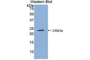 Detection of Recombinant TIMP4, Human using Polyclonal Antibody to Tissue Inhibitors Of Metalloproteinase 4 (TIMP4) (TIMP4 antibody  (AA 32-224))