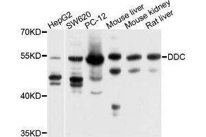 Western blot analysis of extracts of various cells, using DDC antibody. (DDC antibody)