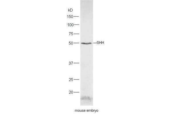 Sonic Hedgehog antibody  (AA 21-120)