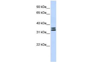 WB Suggested Anti-TAL1 Antibody Titration: 0. (TAL1 antibody  (N-Term))