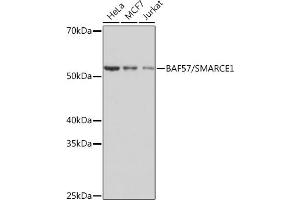 Western blot analysis of extracts of various cell lines, using B/SM Rabbit mAb (ABIN1679391, ABIN3018128, ABIN3018129 and ABIN7101578) at 1:1000 dilution.