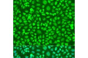 Immunofluorescence analysis of U2OS cells using COQ7 Polyclonal Antibody at dilution of 1:100. (Coq7 antibody)