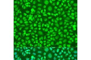 Immunofluorescence analysis of U2OS cells using COQ7 Polyclonal Antibody at dilution of 1:100.