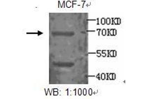 Image no. 1 for anti-Estrogen Receptor 1 (ESR1) antibody (ABIN790861) (Estrogen Receptor alpha antibody)