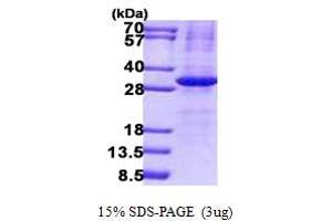 Interleukin 34 (IL34) (AA 21-242) protein (His tag)