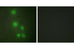 Peptide - +Western blot analysis of extracts from Jurkat cells and COLO205 cells, using ACL6A antibody. (BAF53A antibody  (Internal Region))