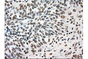 Immunohistochemical staining of paraffin-embedded colon tissue using anti-TYRO3mouse monoclonal antibody. (TYRO3 antibody)