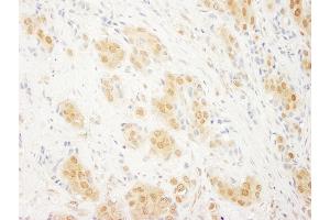Immunohistochemistry (IHC) image for anti-Mitogen-Activated Protein Kinase 1 (MAPK1) (AA 310-360) antibody (ABIN7454543)