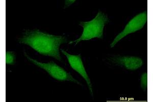 Immunofluorescence of monoclonal antibody to RGS20 on HeLa cell.
