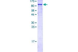 Tumor Protein p73 Protein (AA 1-636) (GST tag)