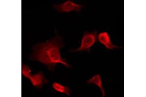 ABIN6267033 staining HuvEc by IF/ICC. (PIM1 antibody  (Internal Region))