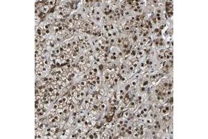 Immunohistochemical staining of human adrenal gland with RRP1B polyclonal antibody  shows strong nuclear positivity in cortical cells at 1:500-1:1000 dilution. (RRP1B antibody)