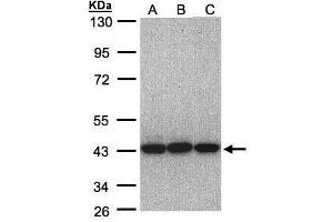WB Image Sample(30 ug whole cell lysate) A:A431, B:H1299 C:Hep G2 , 10% SDS PAGE antibody diluted at 1:1000 (EIF3H antibody)