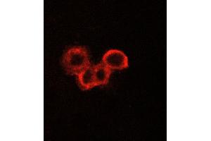 ABIN6269075 staining A549 cells by ICC/IF. (EGFR antibody  (C-Term))
