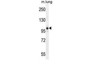 AEBP1 Antibody (Center) western blot analysis in mouse lung tissue lysates (35µg/lane). (AEBP1 antibody  (Middle Region))