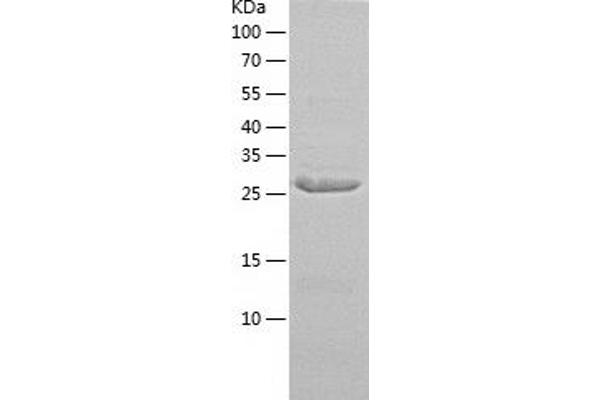 SULT1A1 Protein (AA 1-291) (His tag)