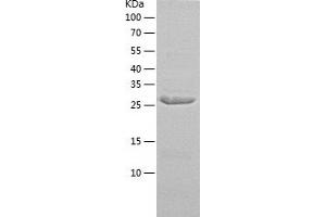 Western Blotting (WB) image for Sulfotransferase Family, Cytosolic, 1A, Phenol-Preferring, Member 1 (SULT1A1) (AA 1-291) protein (His tag) (ABIN7125234) (SULT1A1 Protein (AA 1-291) (His tag))