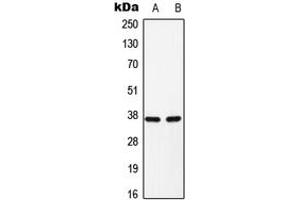 Western blot analysis of C/EBP alpha (pS193) expression in H9C2 (A), Raw264. (CEBPA antibody  (pSer193))