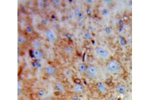 Used in DAB staining on fromalin fixed paraffin-embedded Brain tissue (DPYSL3 antibody  (AA 1-218))