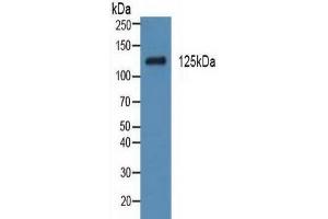 Rabbit Detection antibody from the kit in WB with Positive Control: Human testis tissue. (PDGFRA ELISA Kit)