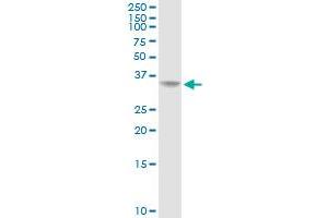 AKR1C2 MaxPab rabbit polyclonal antibody. (AKR1C2 antibody  (AA 1-323))