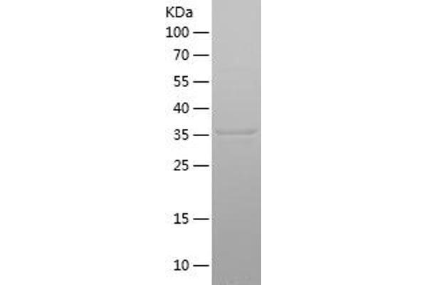 PYGL Protein (AA 745-847) (His-IF2DI Tag)