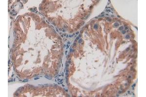 Used in DAB staining on fromalin fixed paraffin- embedded stomach tissue (SPTAN1 antibody  (AA 1004-1181))