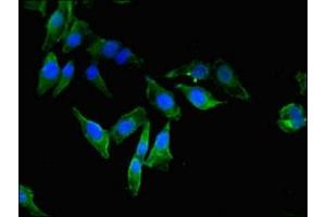 Immunofluorescent analysis of Hela cells using ABIN7152101 at dilution of 1:100 and Alexa Fluor 488-congugated AffiniPure Goat Anti-Rabbit IgG(H+L) (EEF2K antibody  (AA 201-500))