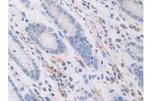 Figure. (PZP antibody  (AA 1212-1391))