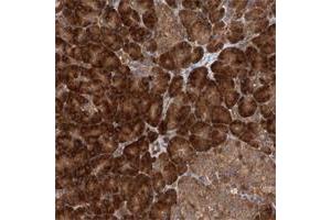 Immunohistochemical staining of human prostate with LURAP1 polyclonal antibody  shows moderate cytoplasmic and membranous positivity in glandular cells at 1:50-1:200 dilution.