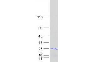 Validation with Western Blot (CIRBP Protein (Transcript Variant 1) (Myc-DYKDDDDK Tag))