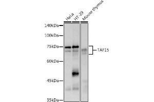 Western blot analysis of extracts of various cell lines, using (ABIN7270715) at 1:500 dilution.