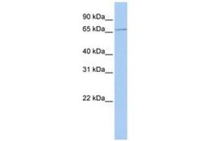 Image no. 1 for anti-Sex Comb On Midleg Homolog 1 (SCMH1) (AA 180-229) antibody (ABIN6740271) (SCMH1 antibody  (AA 180-229))
