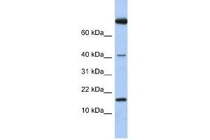 IL4 antibody used at 1 ug/ml to detect target protein.