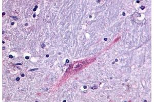 Anti-GPR55 antibody  ABIN1048838 IHC staining of human brain, putamen. (GPR55 antibody  (C-Term))