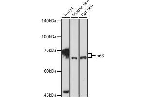 Western Blotting (WB) image for anti-Tumor Protein P63 (TP63) (AA 421-680) antibody (ABIN3023012)