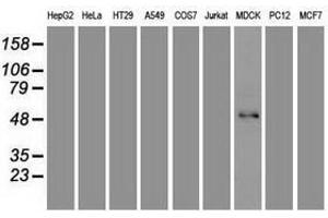 Image no. 2 for anti-Forkhead Box A1 (FOXA1) (AA 1-473) antibody (ABIN1490773)