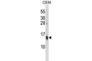 Western blot analysis in CEM cell line lysates (35ug/lane) using SPRR3 / Cornifin beta Antibody (C-term).