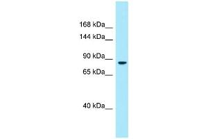 WB Suggested Anti-DMGDH Antibody Titration: 1. (DMGDH antibody  (C-Term))